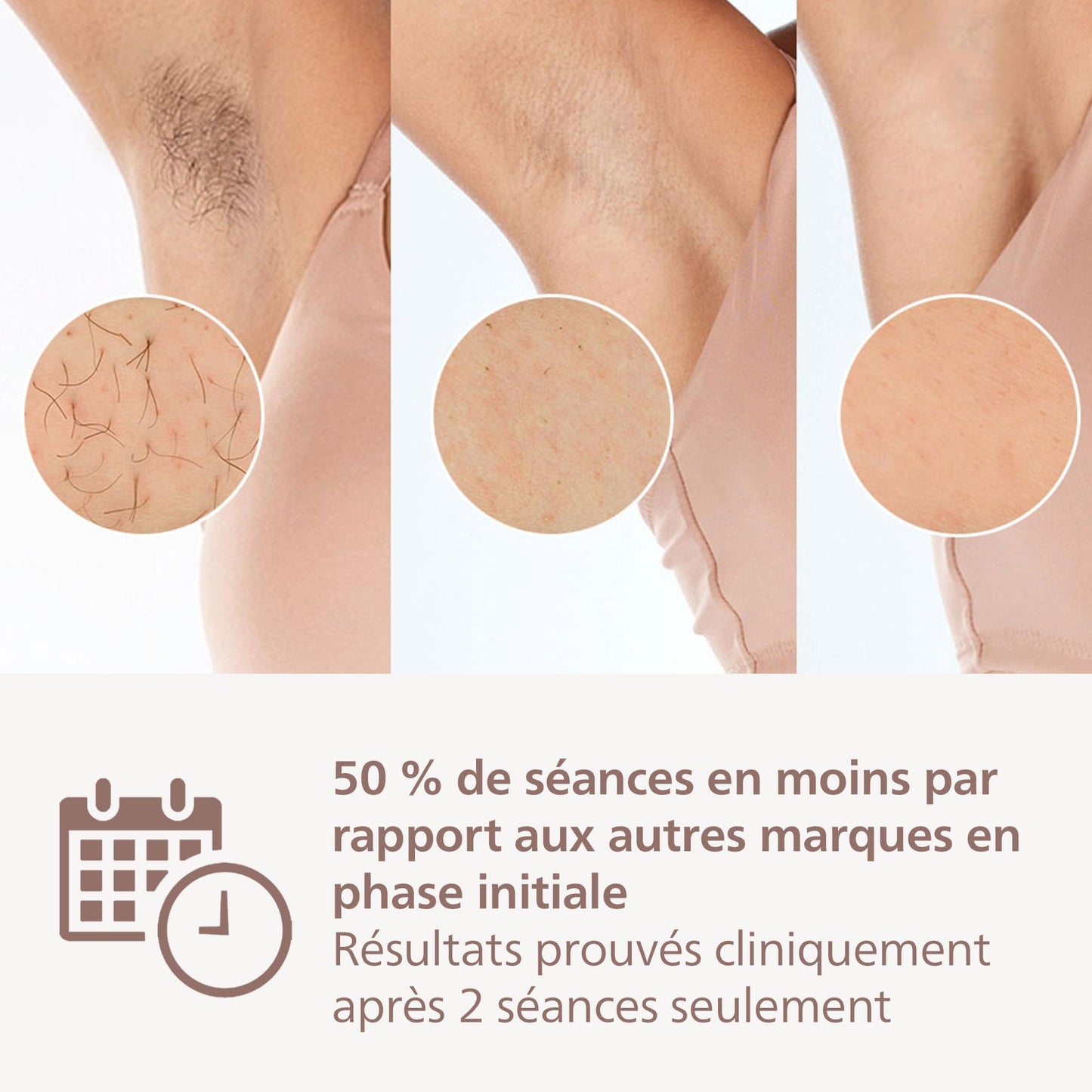 Philips Lumea série 8000 - épilateur à lumière pulsée, alternative à l'épilation laser, technologie SenseIQ, 3 embouts pour le corps, le visage et les zones de précision, BRI946/00
